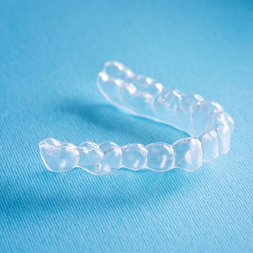 een splint voor in het gebit