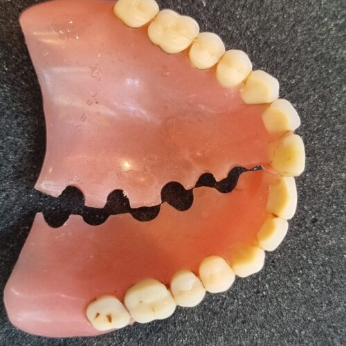 Kapotte prothese voor reparatie